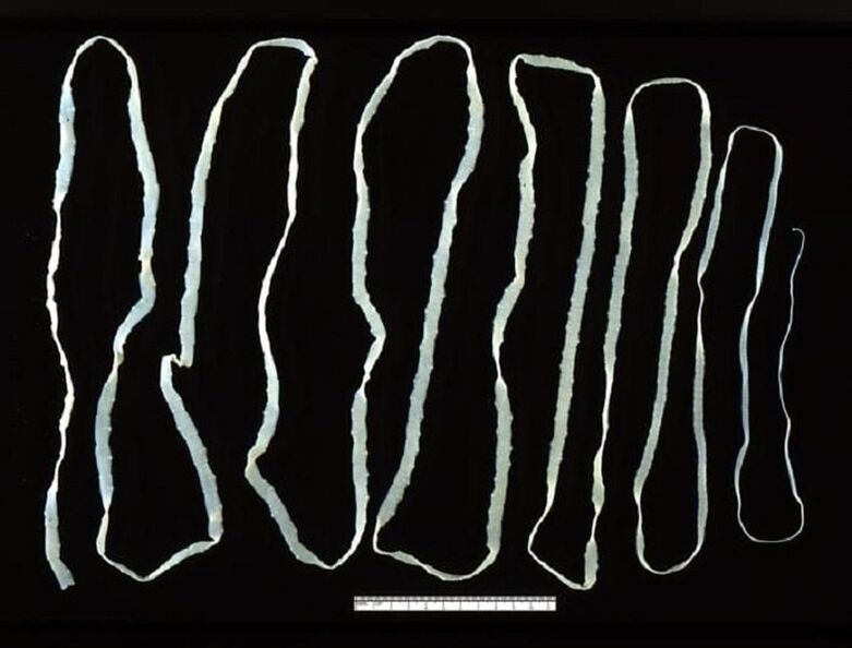 Tapeworm extracted from the human intestine
