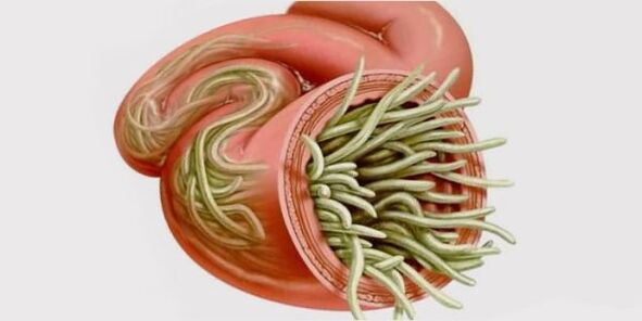 worms in humans
