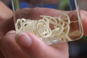 parasites from the human body